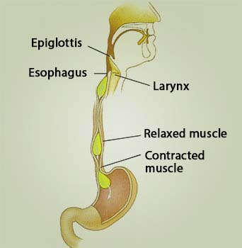 Achalasia Cardia Introduction - WelcomeCure