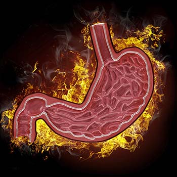 achalasia cardia related conditions