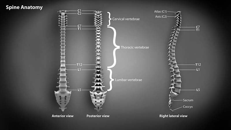 back pain definition