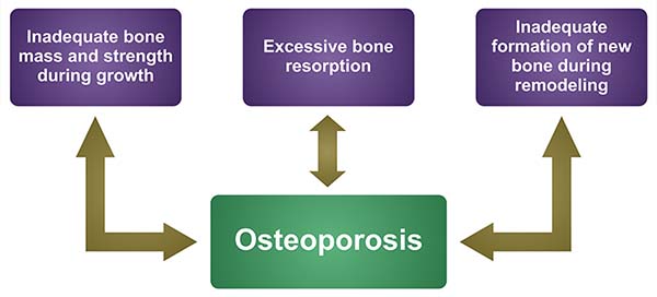 osteoporosis introduction for assignment