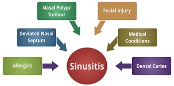 Causes of Sinusitis