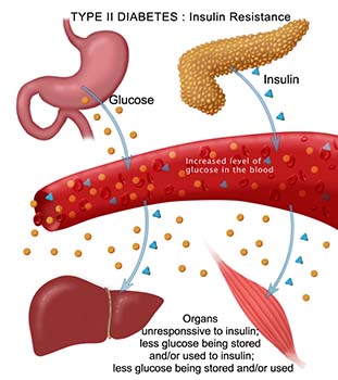 diabetes introduction