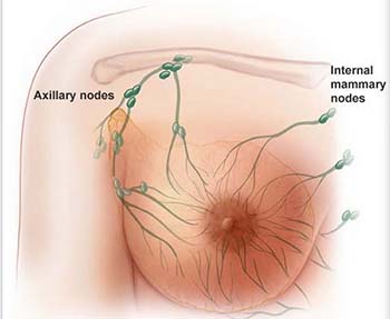 fibroadenoma of breast introduction