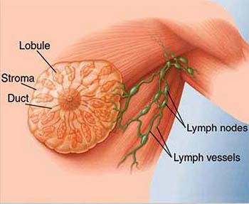 introduction of fibroadenoma of breast