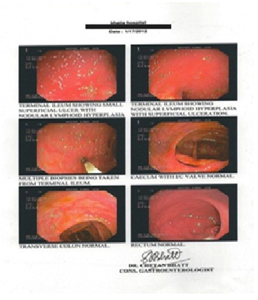 Before treatment Abscess-case img1